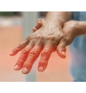 Polyneuropathie